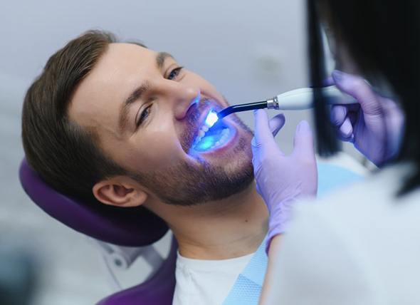 Dentist curing a patient’s tooth-colored filling