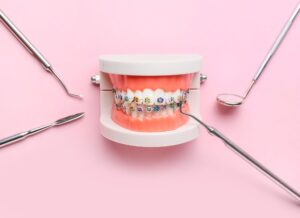 Model teeth with braces on a pink background with dental instruments